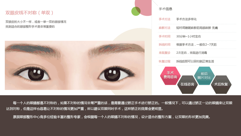 韩式眼部综合整形价格