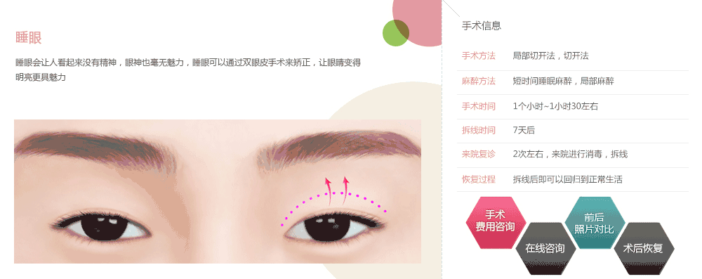 韩式眼部整形手术哪家好