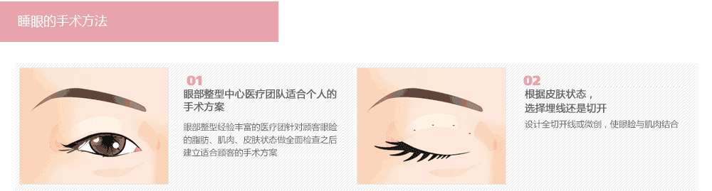 眼部整形医院哪里好