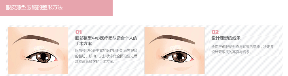 双眼距离远且窄