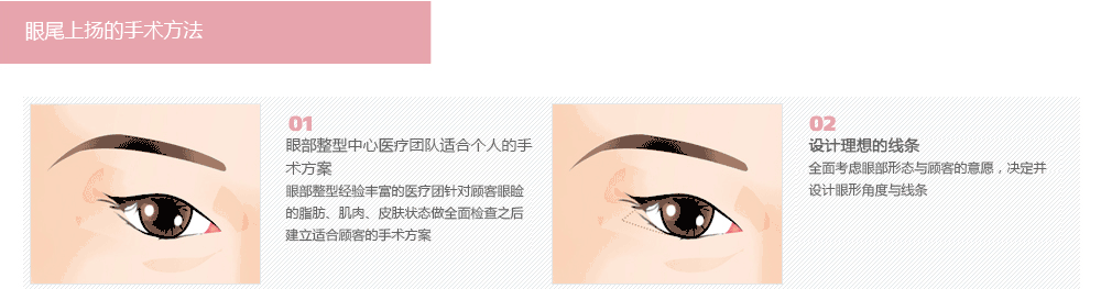 韩式眼部综合整形