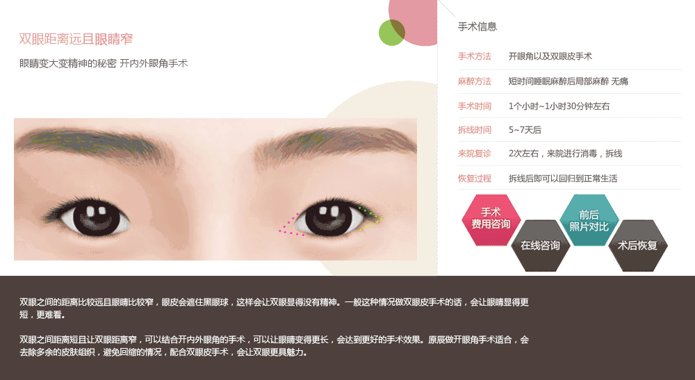 韩国哪里做双眼皮手术好