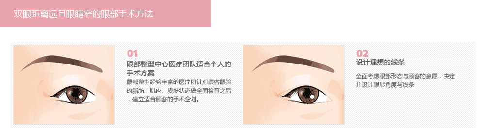 做韩式双眼皮手术