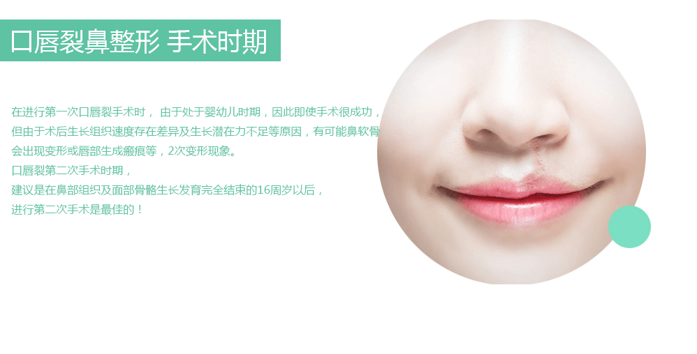 口唇裂鼻整形