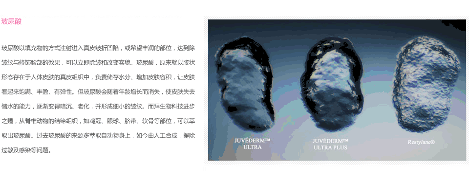 玻尿酸效果怎么样