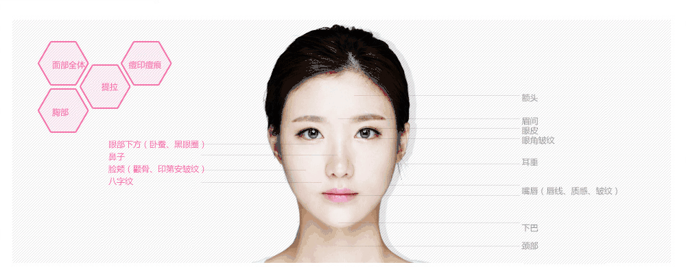 注射玻尿酸没有副作用