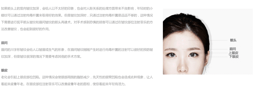 注射玻尿酸的过程1