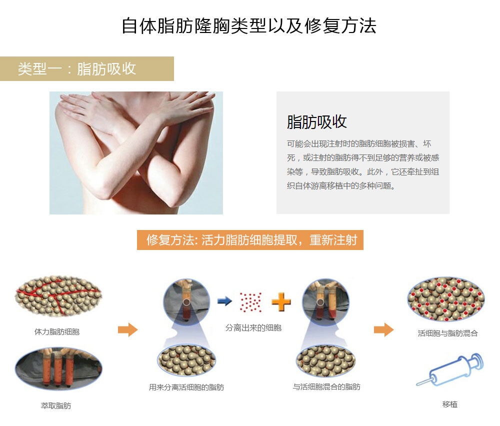 韩国隆胸失败修3