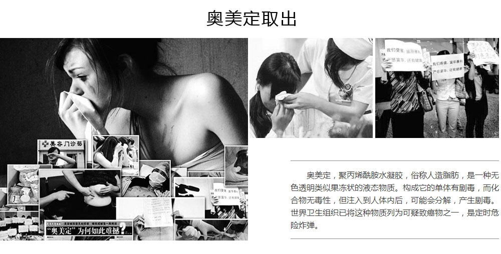 韩国隆胸失败修7