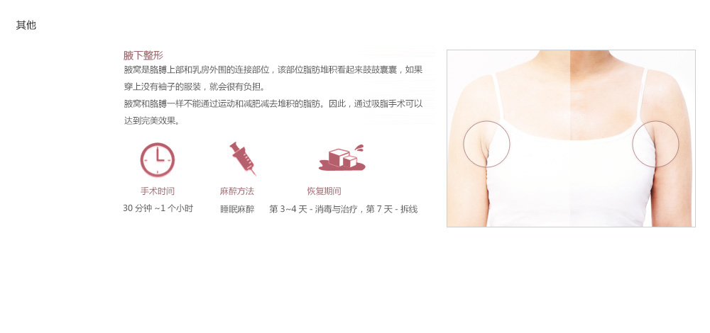 韩国原辰吸脂减肥