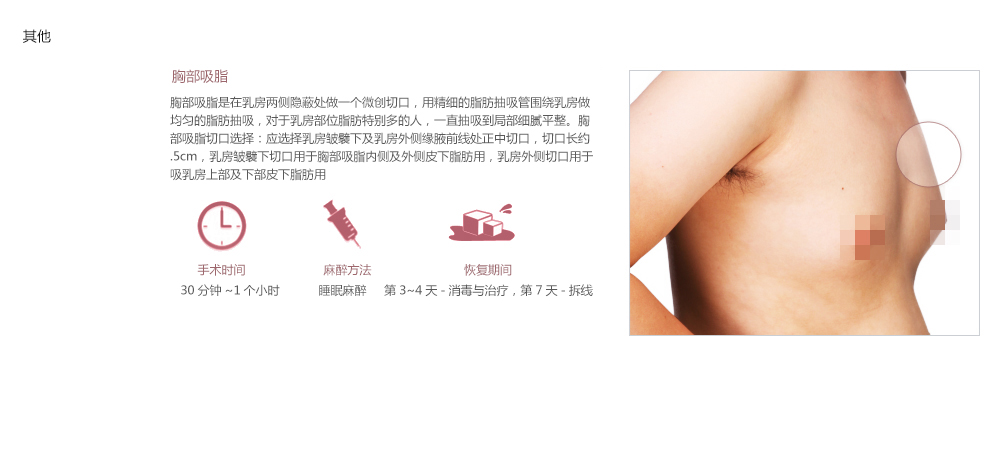 韩国原辰吸脂减肥优势