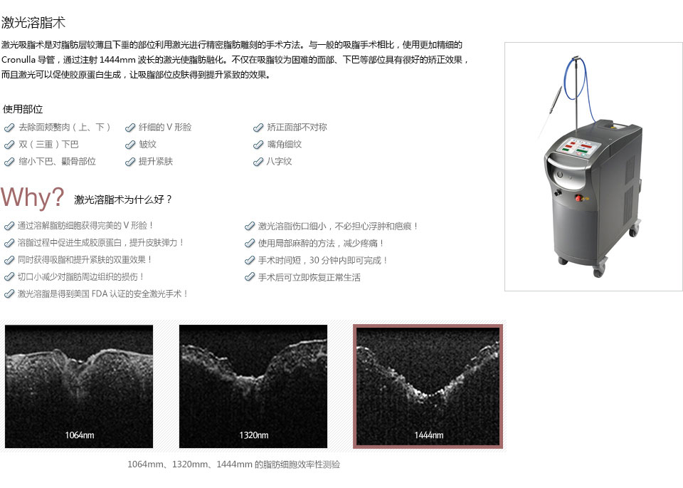 韩式吸脂减肥手术