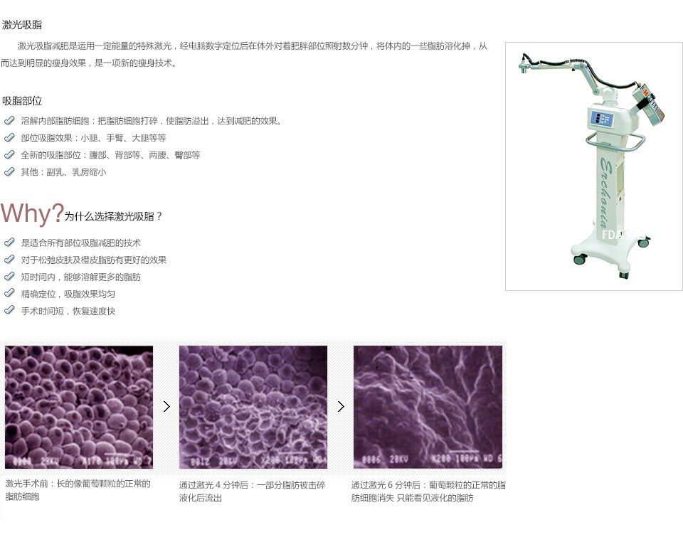 韩式吸脂减肥大概多少钱
