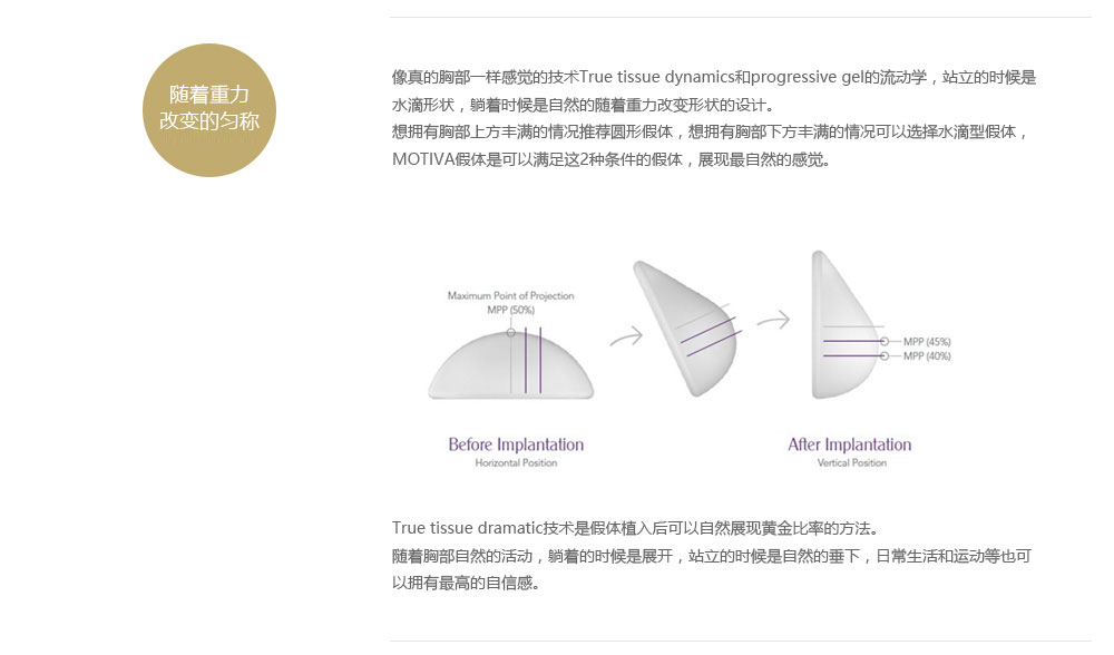 MOTIVA PREMIUM 胸部整形